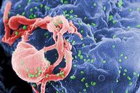 Ranbaxy Laboratories gets tentative approval for HIV combination therapy