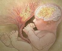 Autism Risk Predicted by Abnormal Placenta, Shows Study