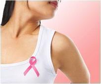 Protein Responsible for Breast Cancer Recurrence Discovered