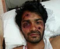 Mrunal Jain beaten black and blue!