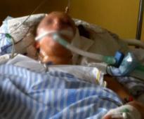 Mumbai Railway Station Acid Attack: Victim critical, Railways to foot medical bills