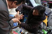 City Room: Hands, Disfigured in Fire, Are Now Essential to Livelihood