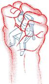 Ugly truth: Sometimes, torture works