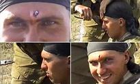 Russian soldier shot in the head by an AK-47 smiles for the camera as his comrade pulls it out using just PLIERS  | Mail Online