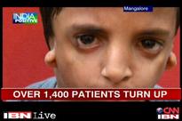 Mangalore: Hospital gives free surgeries to fix facial deformities