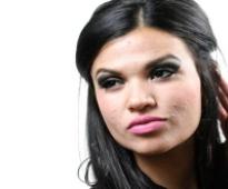 Cure acne without elaborate face packs