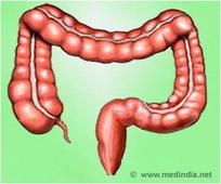 Doctors Able To Remove Suspicious Polyps, Keep Colon Intact With the Help Of New Alternative to Surgery