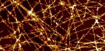 Trigger for onset of Alzheimer's discovered