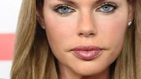 Australia's most botoxed celebs