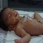 9 infants die during one night in Malda Medical Hospital