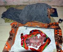 PICTURES: Woman Delivers Conjoined Twins Amid 'Black Magic' Rumours